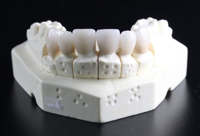 etansare dentara