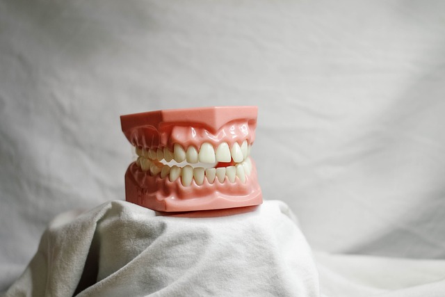 Ce este incrustația ceramică dentară